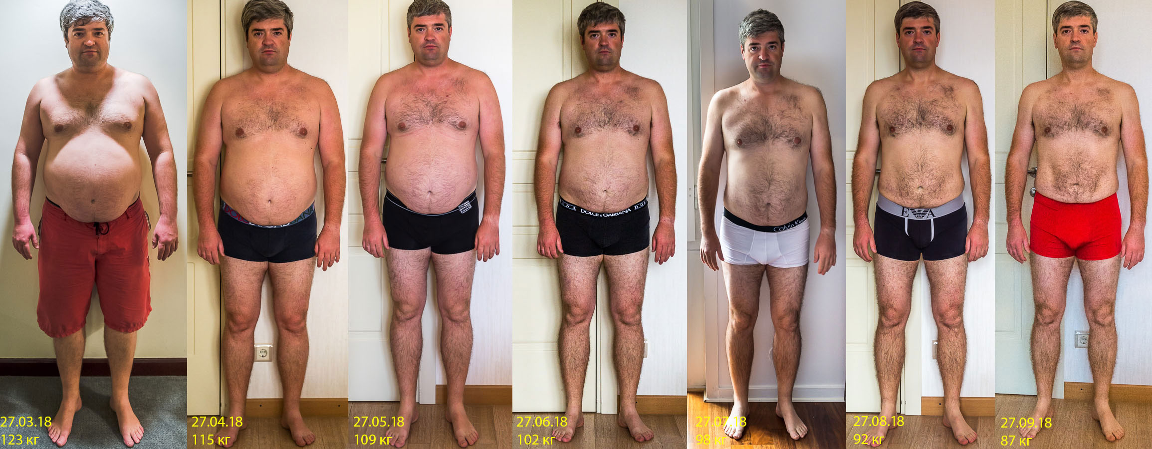 Ноги мужские до и после похудения